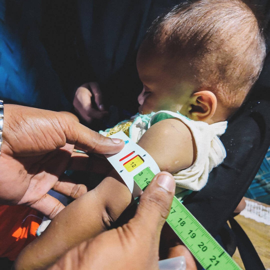 A health worker measures a young child’s arm with MUAC tape while the child is held by her mother. The tape shows yellow, indicating moderate acute malnutrition.
